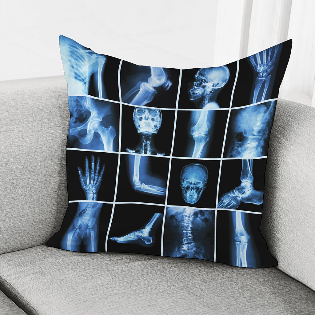 X-Ray Film Radiology Print Pillow Cover