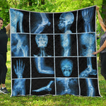X-Ray Film Radiology Print Quilt
