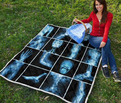X-Ray Film Radiology Print Quilt