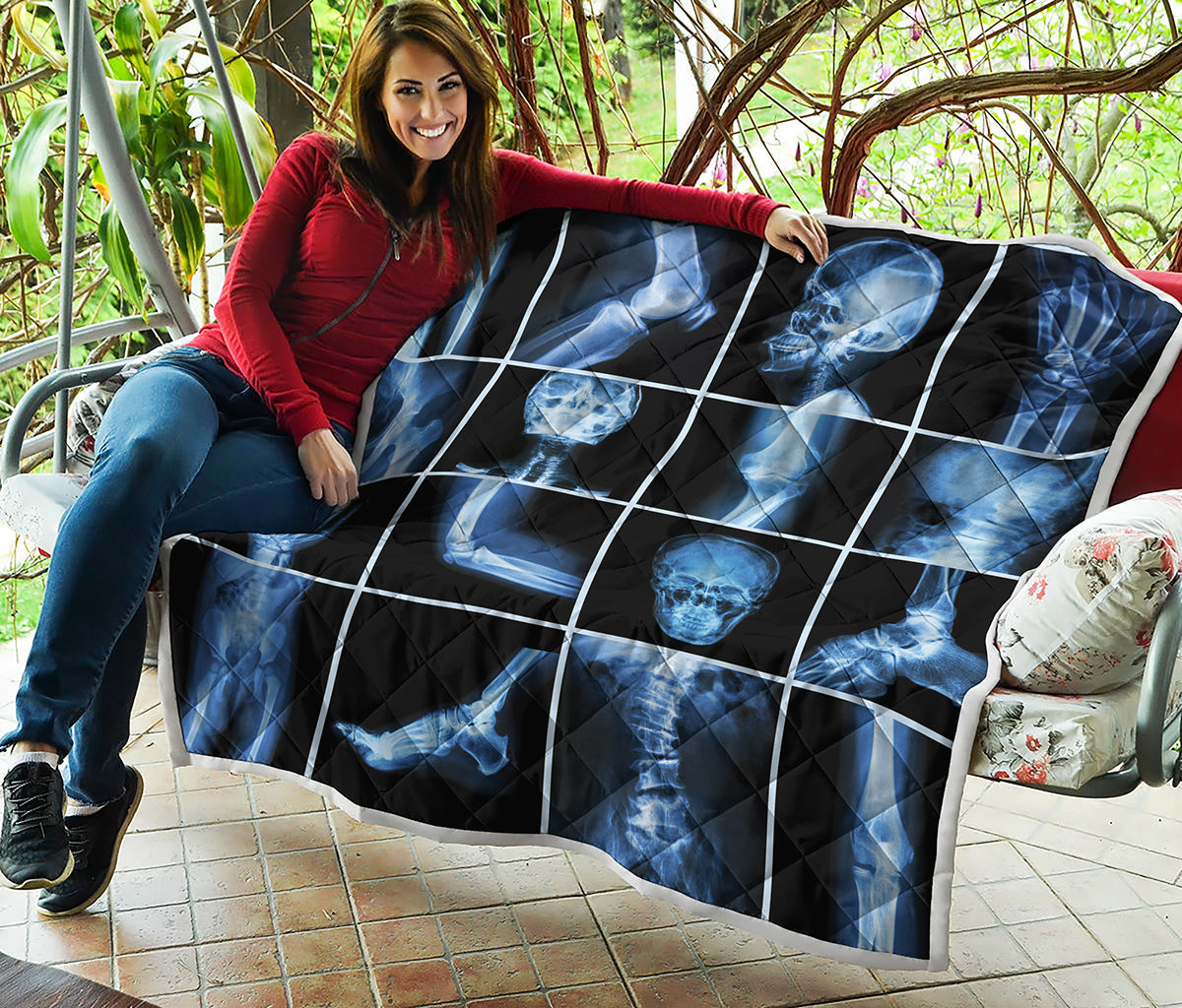 X-Ray Film Radiology Print Quilt