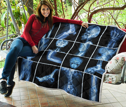 X-Ray Film Radiology Print Quilt