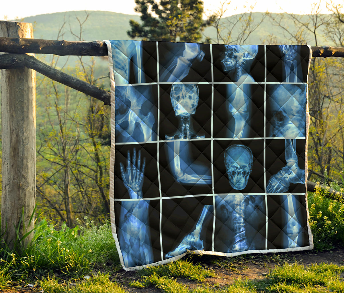 X-Ray Film Radiology Print Quilt