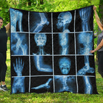 X-Ray Film Radiology Print Quilt