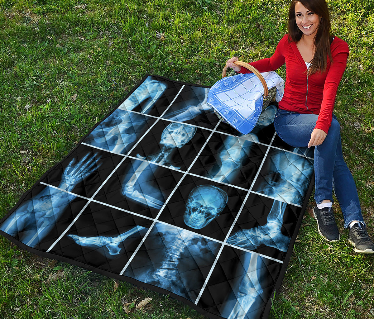 X-Ray Film Radiology Print Quilt