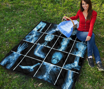 X-Ray Film Radiology Print Quilt