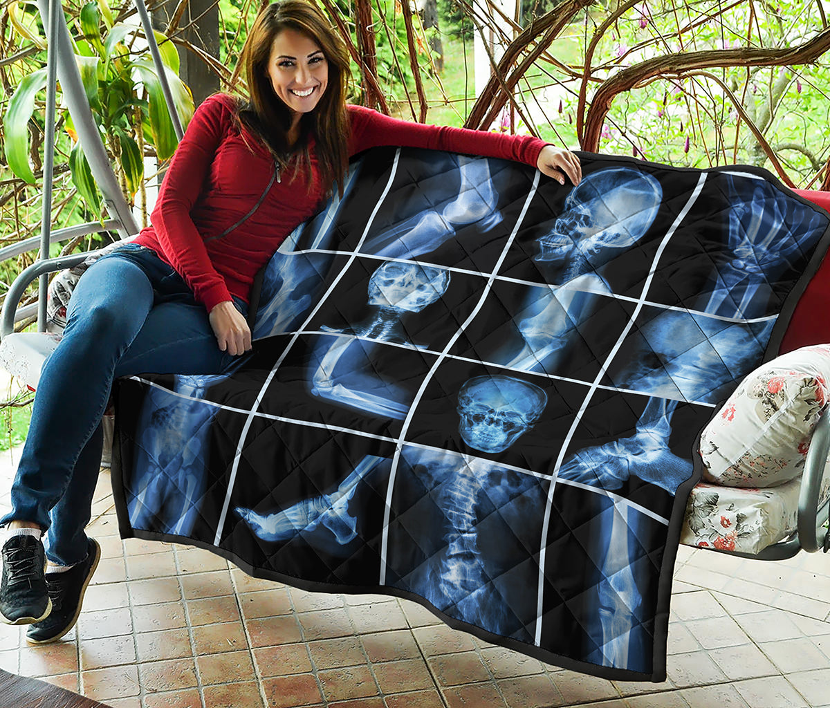 X-Ray Film Radiology Print Quilt