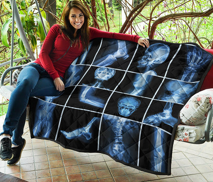 X-Ray Film Radiology Print Quilt