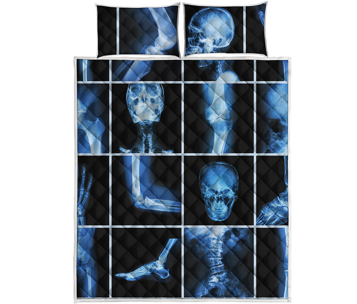 X-Ray Film Radiology Print Quilt Bed Set