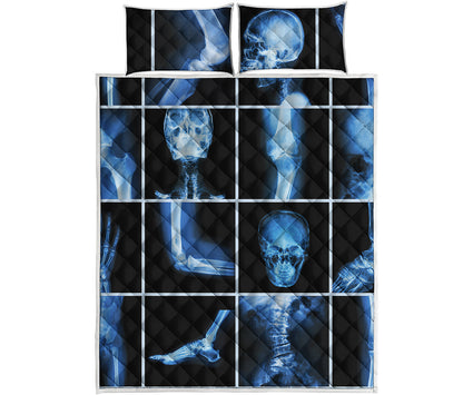 X-Ray Film Radiology Print Quilt Bed Set