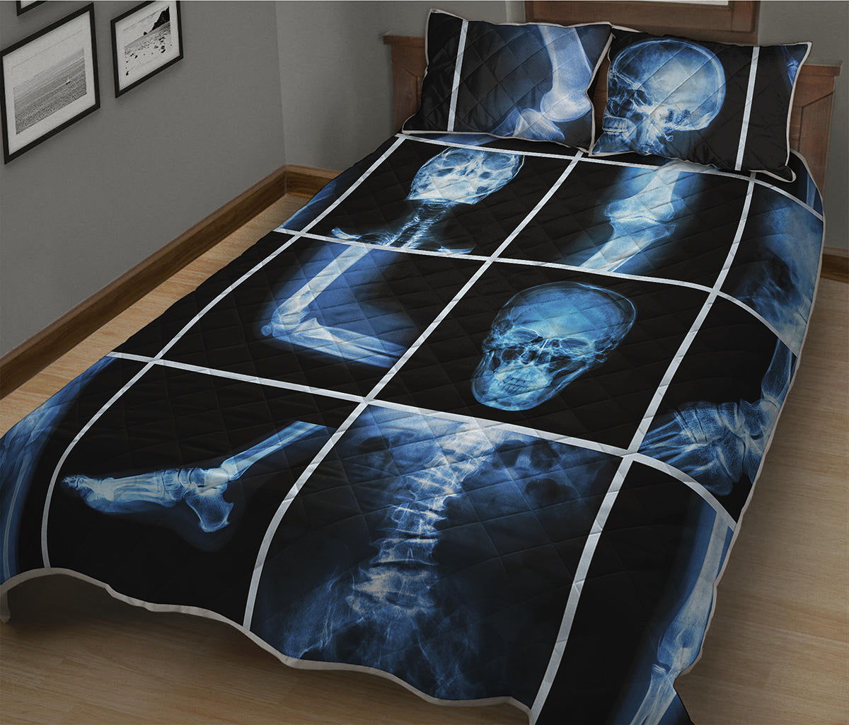 X-Ray Film Radiology Print Quilt Bed Set