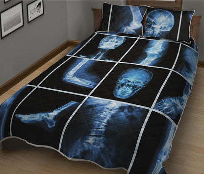 X-Ray Film Radiology Print Quilt Bed Set