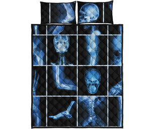 X-Ray Film Radiology Print Quilt Bed Set
