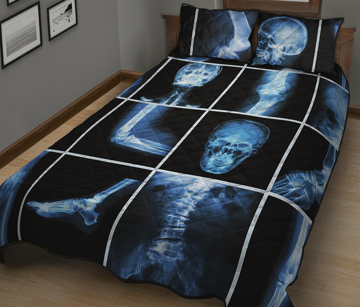 X-Ray Film Radiology Print Quilt Bed Set