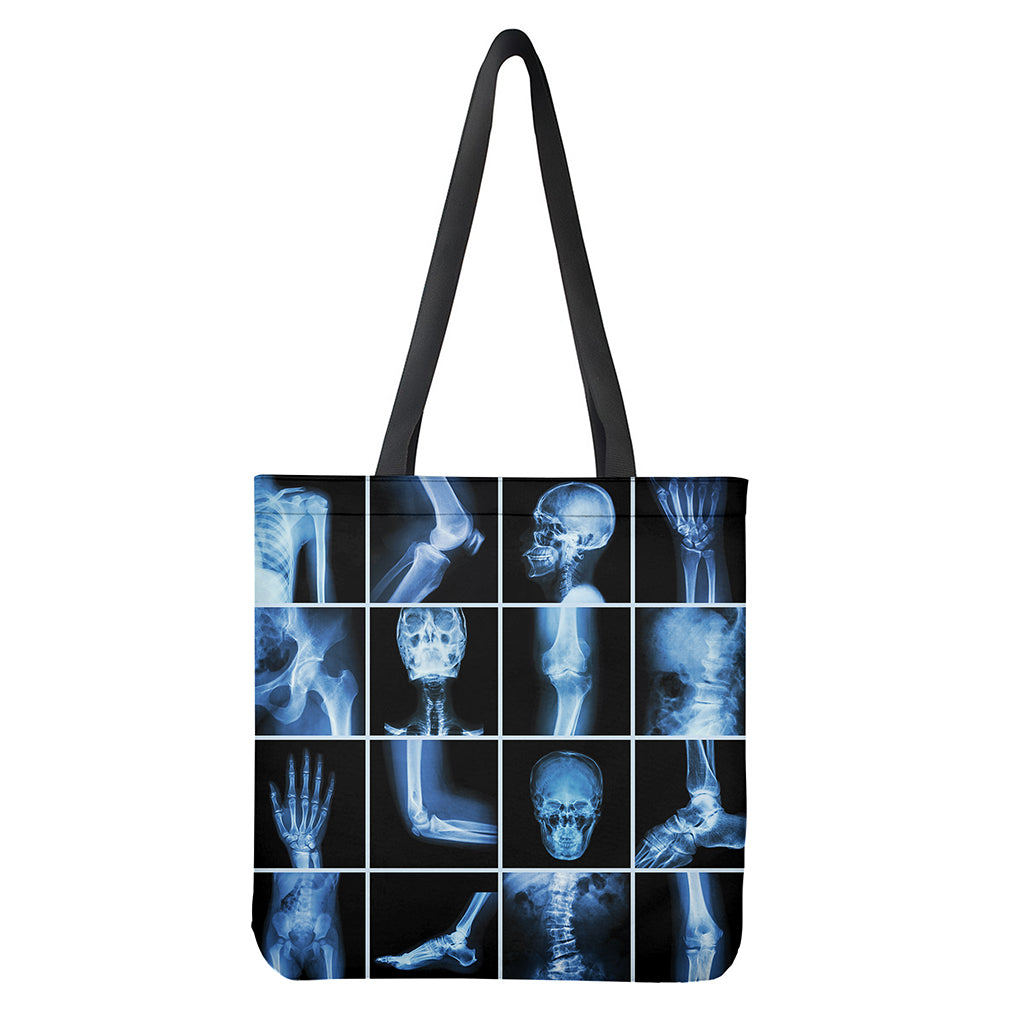 X-Ray Film Radiology Print Tote Bag