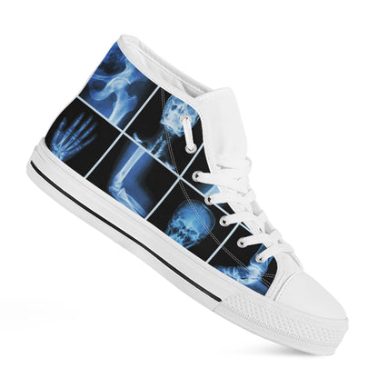 X-Ray Film Radiology Print White High Top Shoes