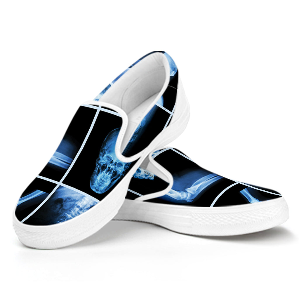 X-Ray Film Radiology Print White Slip On Shoes
