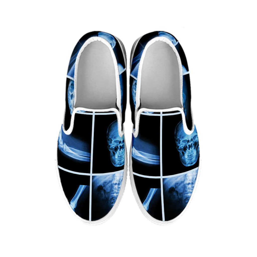 X-Ray Film Radiology Print White Slip On Shoes