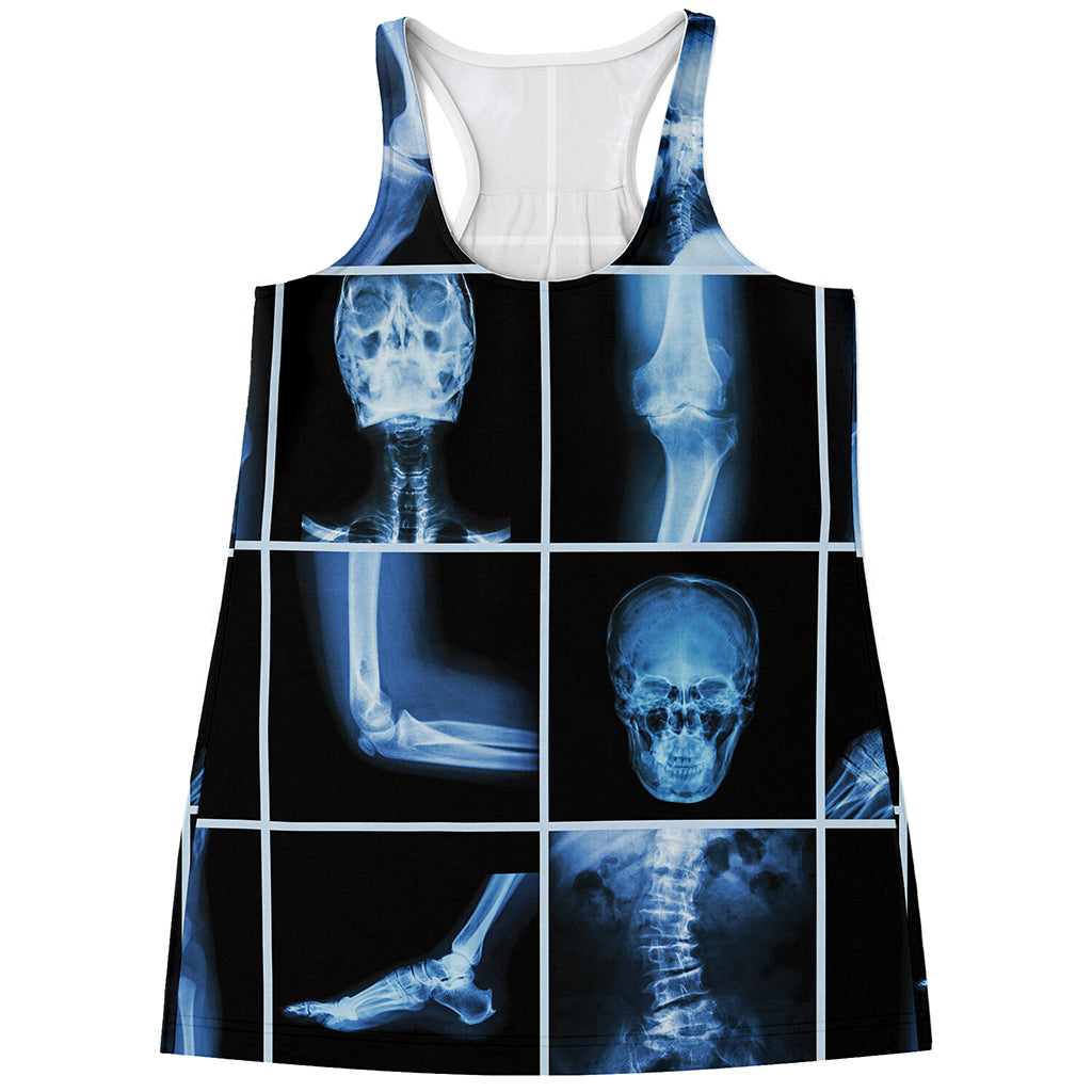 X-Ray Film Radiology Print Women's Racerback Tank Top