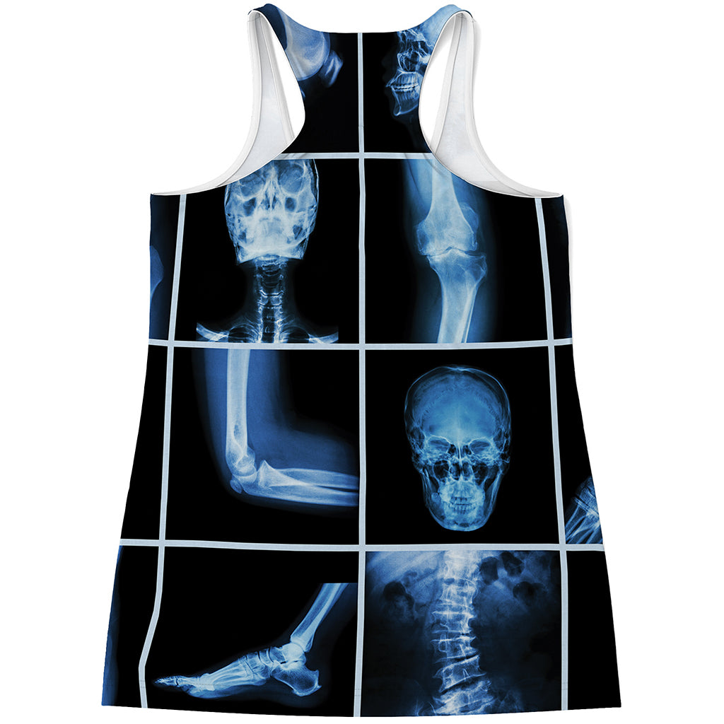 X-Ray Film Radiology Print Women's Racerback Tank Top