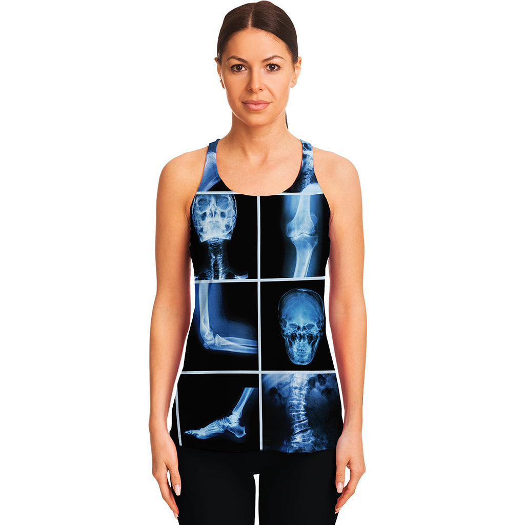 X-Ray Film Radiology Print Women's Racerback Tank Top
