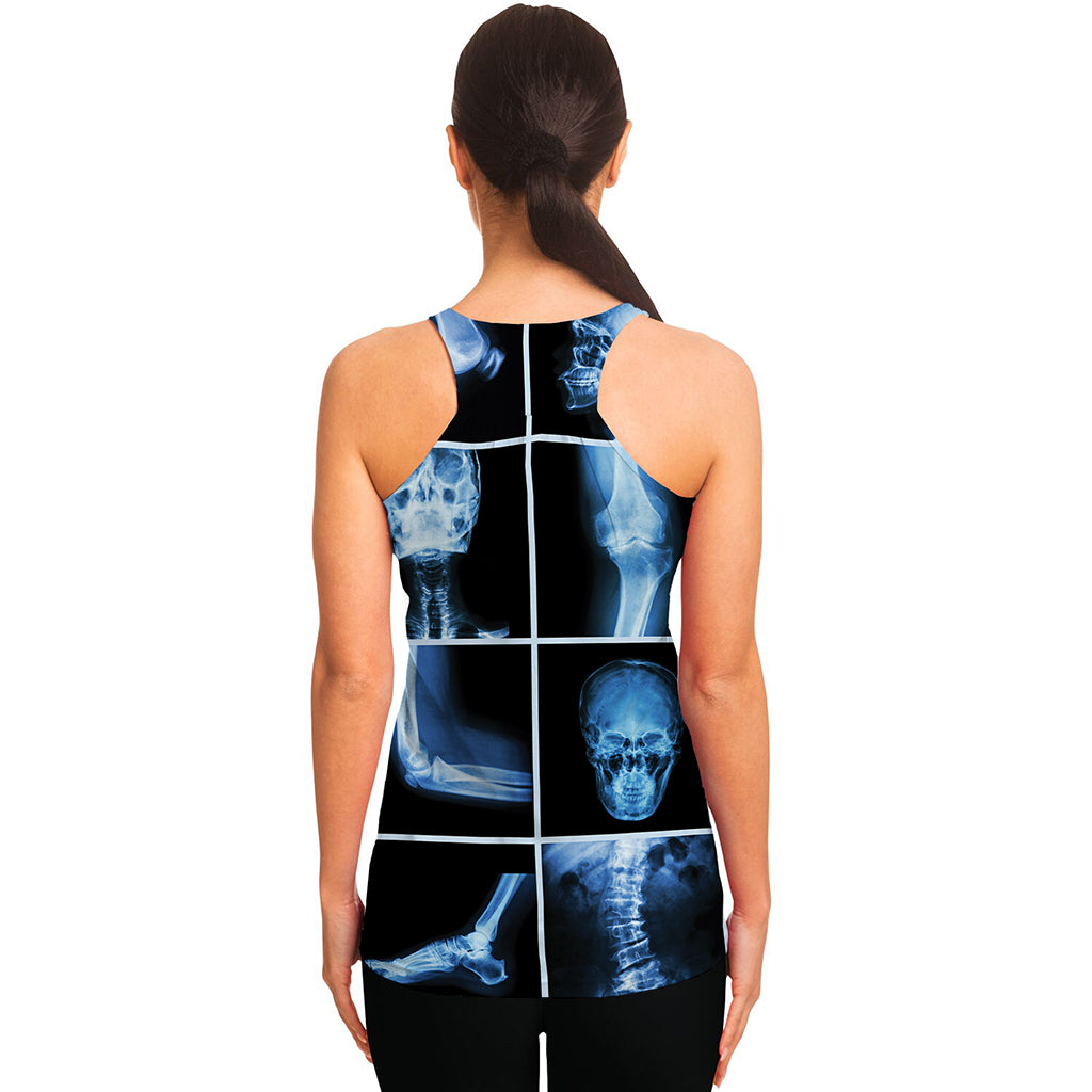 X-Ray Film Radiology Print Women's Racerback Tank Top