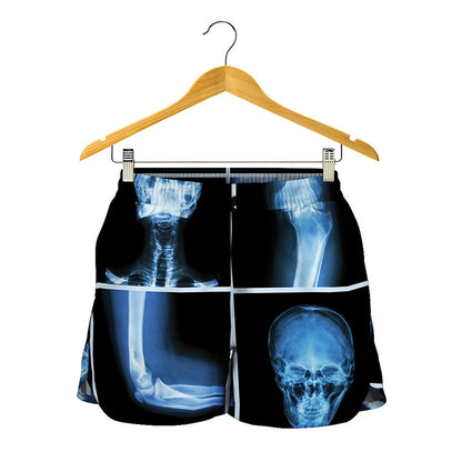 X-Ray Film Radiology Print Women's Shorts