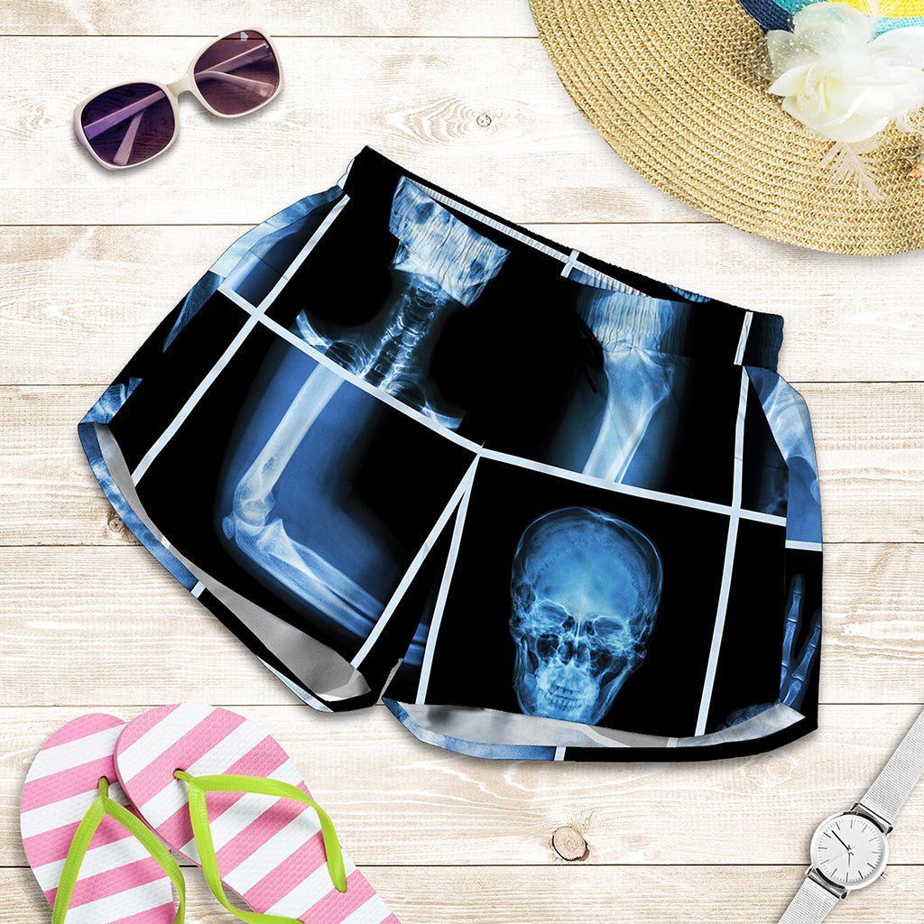 X-Ray Film Radiology Print Women's Shorts